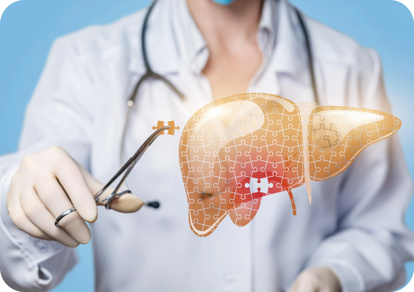 Liver Transplant Overview