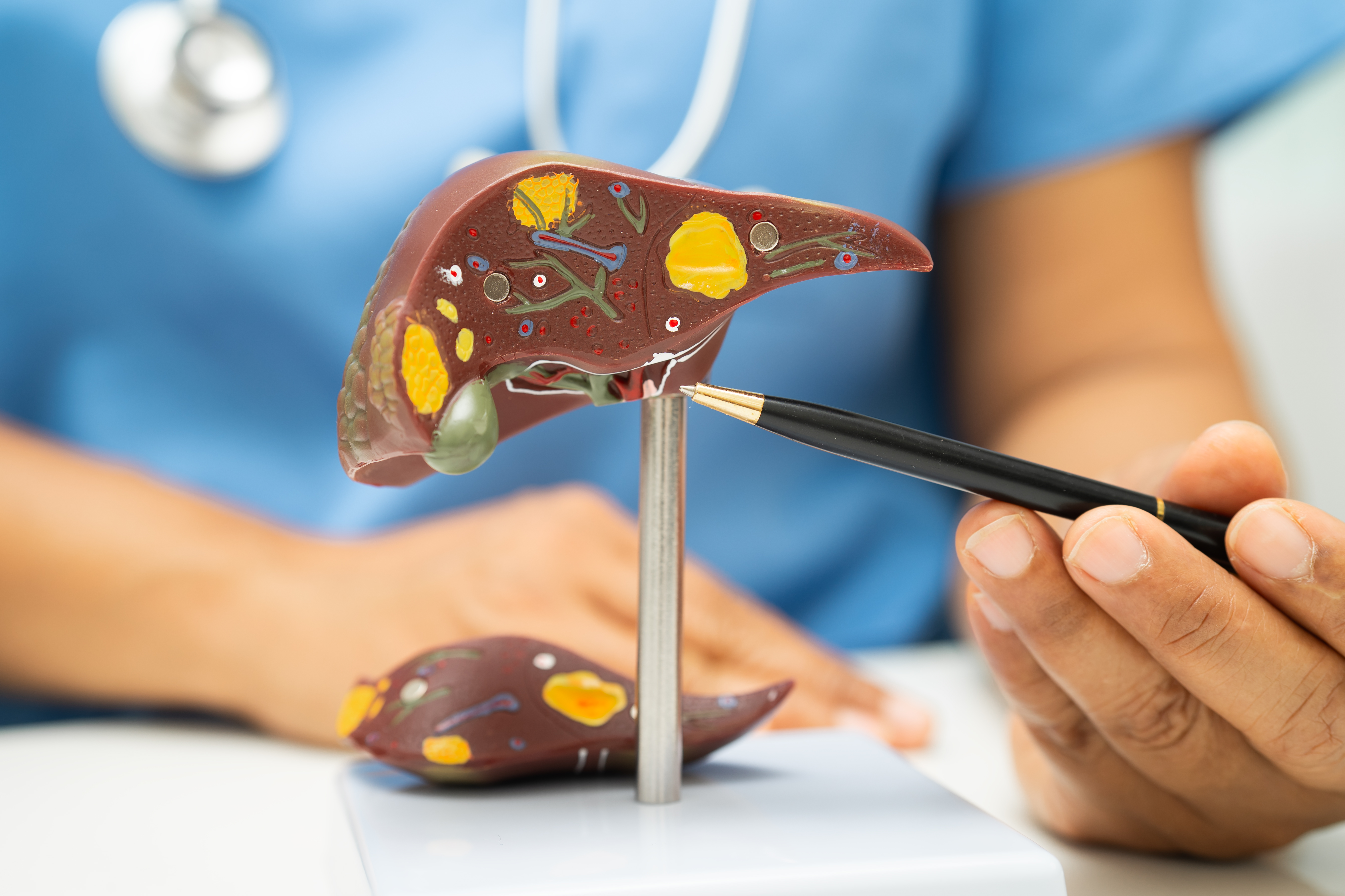 Liver Transplant Overview